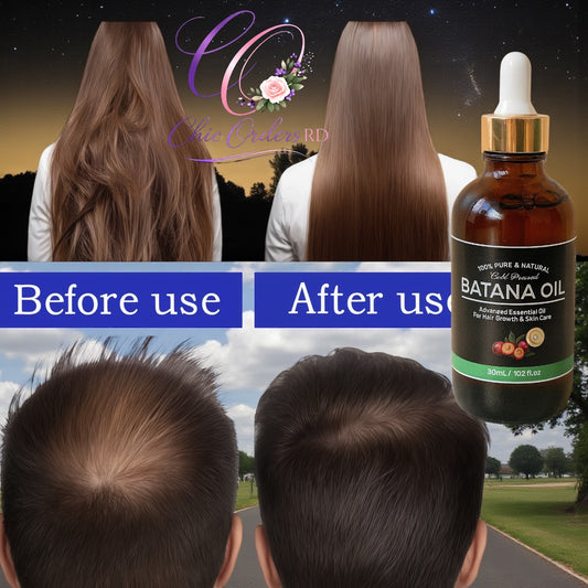 ACEITE DE BATANA - FORMULA MEJORADA 100% NATURAL